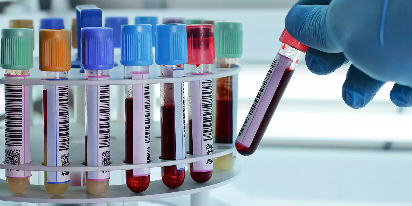 PCR ve Antikor Testi
